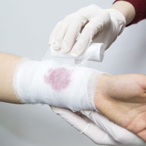 A healthcare professional wearing gloves is bandaging a wound on a person's wrist. The bandage has a visible bloodstain. The person receiving care has a floral-patterned sleeve, and the professional is wearing a burgundy sleeve.