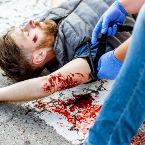 A person with a bloody arm injury lies on the ground. Another individual wearing blue gloves applies a tourniquet to the injured arm. There is a pool of blood on the pavement nearby.