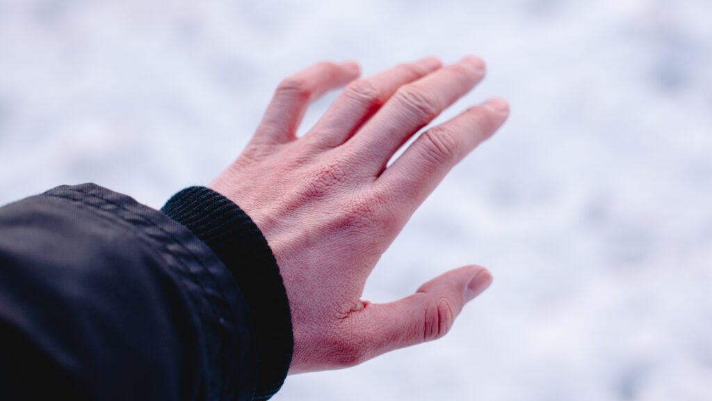 Close-up of a person's hand reaching out against a blurred snowy background. The skin appears slightly red, suggesting cold exposure. The arm is covered with a dark jacket.