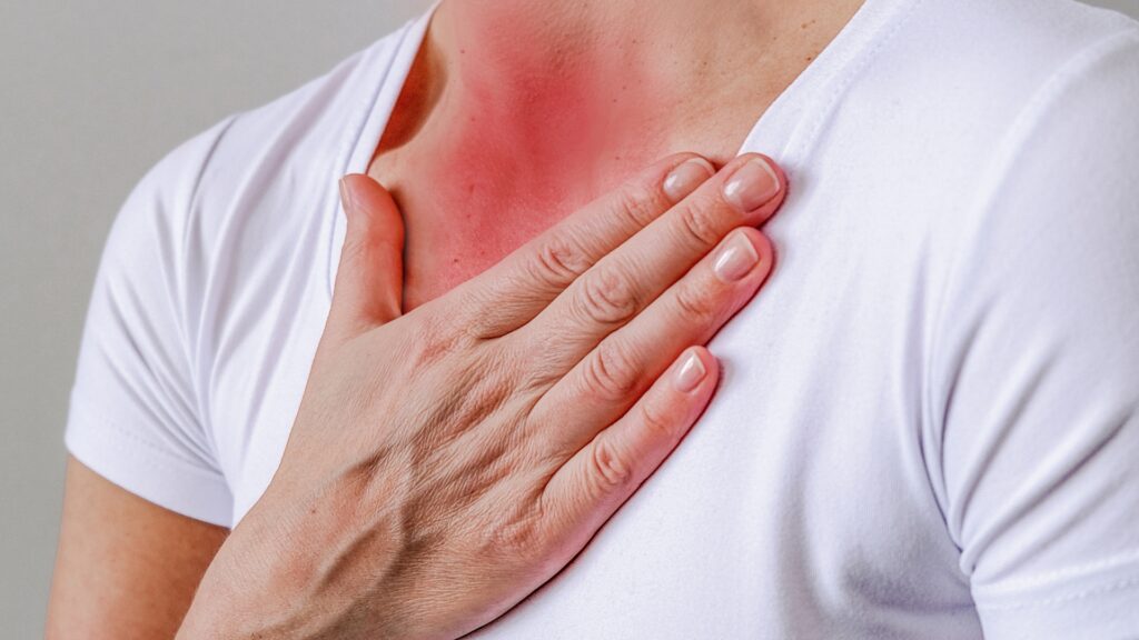 A person wearing a white shirt places their hand on their upper chest, which appears red, possibly indicating pain or irritation.