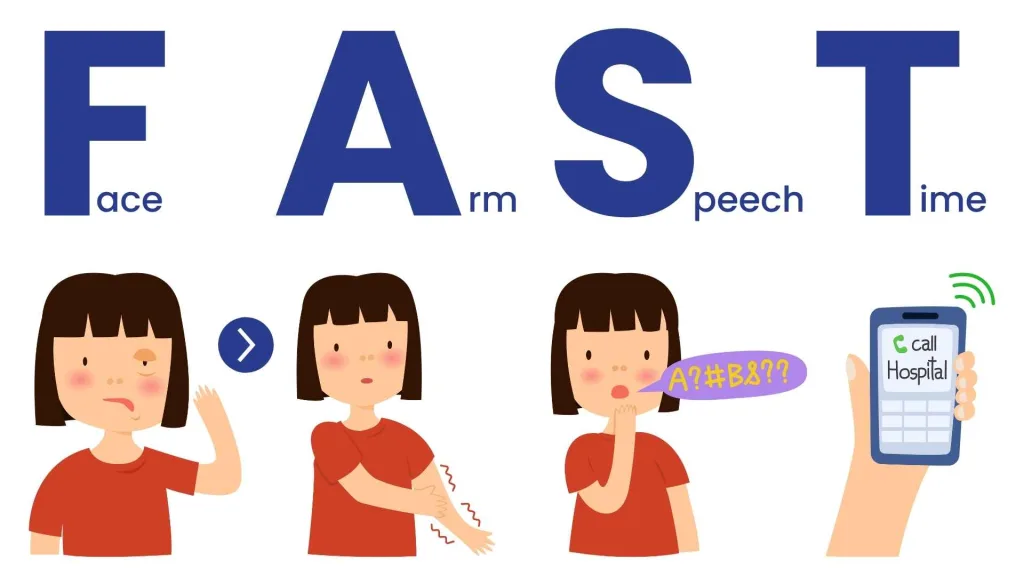 stroke fast acronym